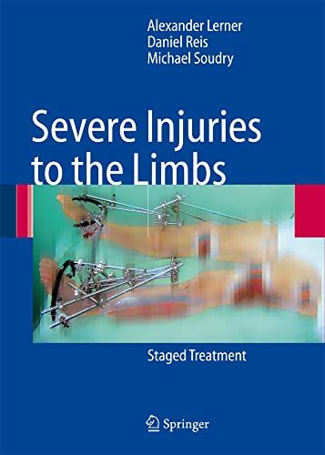 Severe Injuries to the Limbs Staged Treatment Alexander Ler
