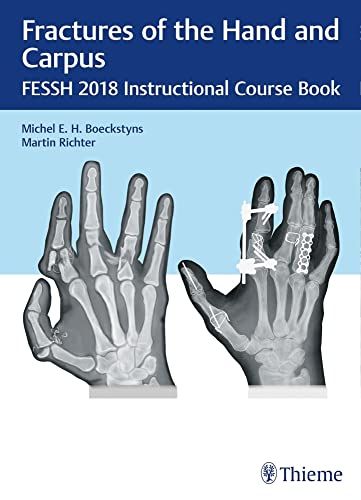 Fractures of the Hand and Carpus FESSH 2018 Instructional C