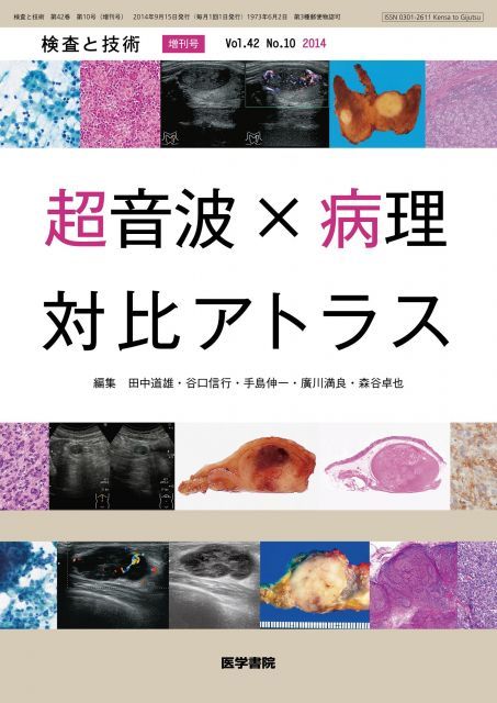非常に良い】検査と技術 2014年09月号 注文 増刊号 超音波