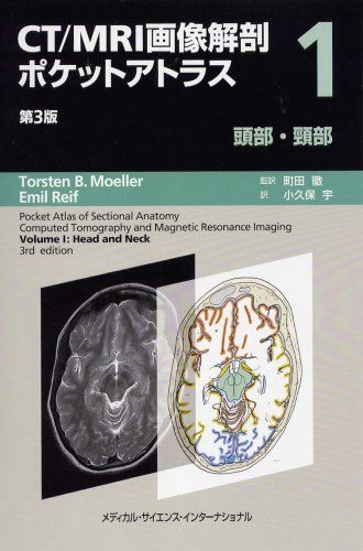 CT/MRI画像解剖ポケットアトラス 第3版 第1巻 頭部・頸部／町田 徹