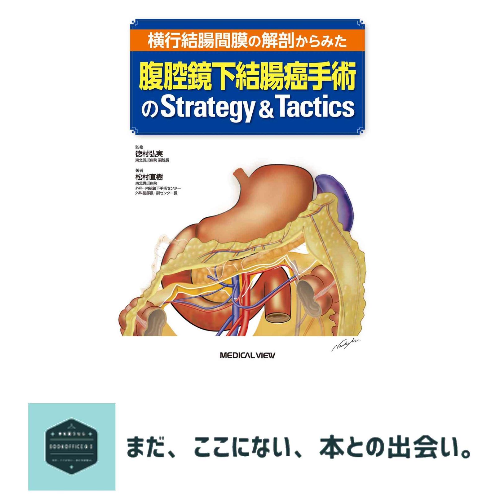 横行結腸間膜の解剖からみた 腹腔鏡下結腸癌手術のStrategy & Tactics