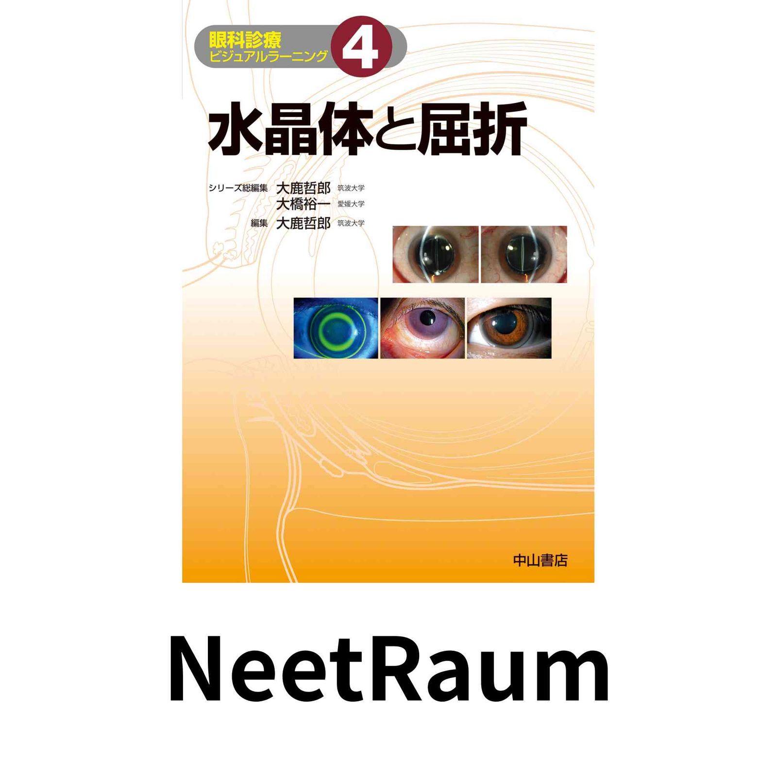 水晶体と屈折 眼科診療ビジュアルラーニング 単行本 大鹿哲郎