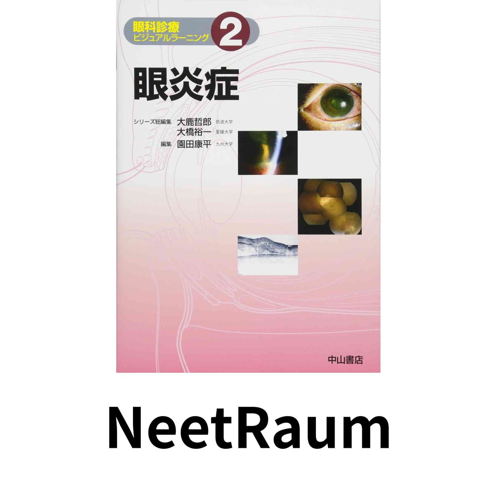 眼炎症 眼科診療ビジュアルラーニング 単行本 園田康平