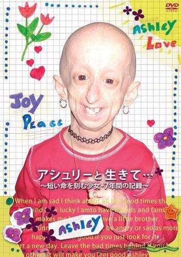 アシュリーと生きて 短い命を刻む少女 7年間の記録 DVD