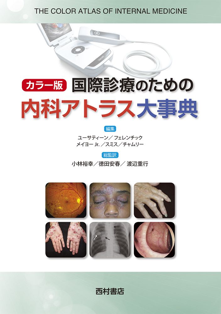 カラー版国際診療のための内科アトラス大事典/西村書店（新潟
