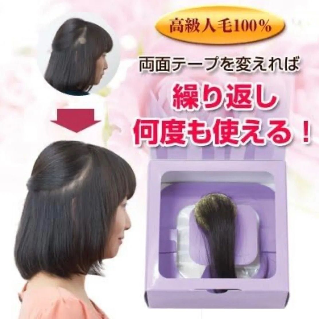 新品 円形脱毛隠しシート つけ毛 貼付け 医療用両面テープ1箱(25枚)付き ウィッグ