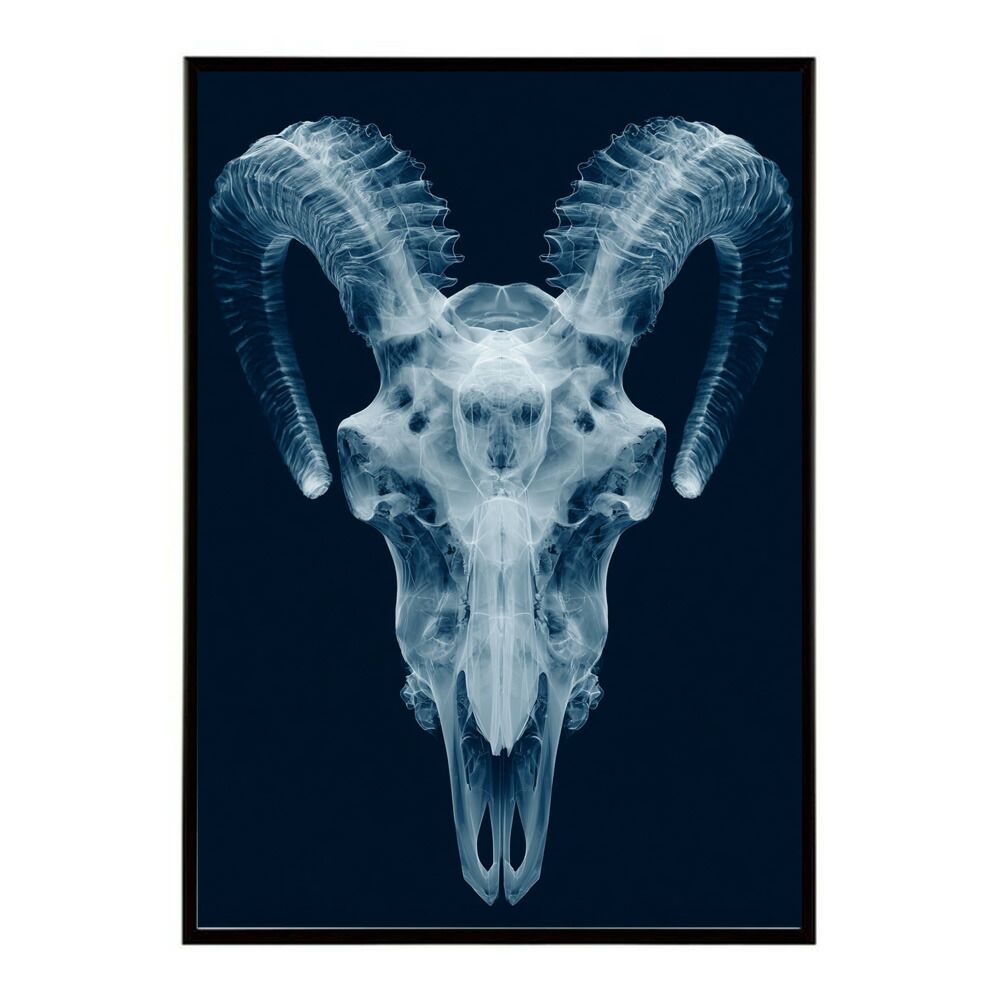 4iiii 固定ローラー センサー付き※説明要確認