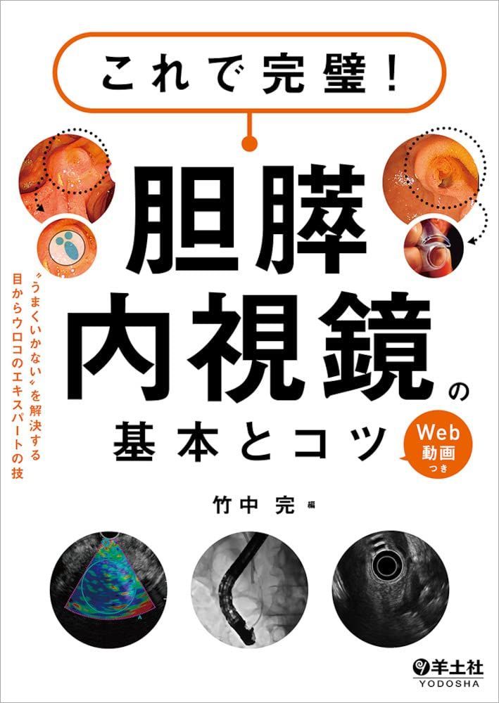 これで完璧! 胆膵内視鏡の基本とコツ- うまくいかないを解決する目からウロコのエキスパートの技