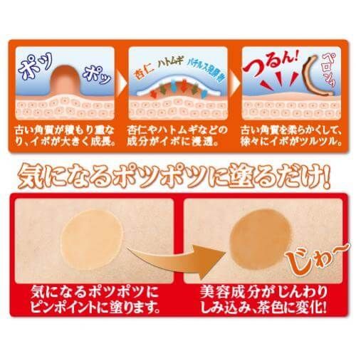 イポロン P 20g 3個セット ハトムギ クリーム 角質 送料無料