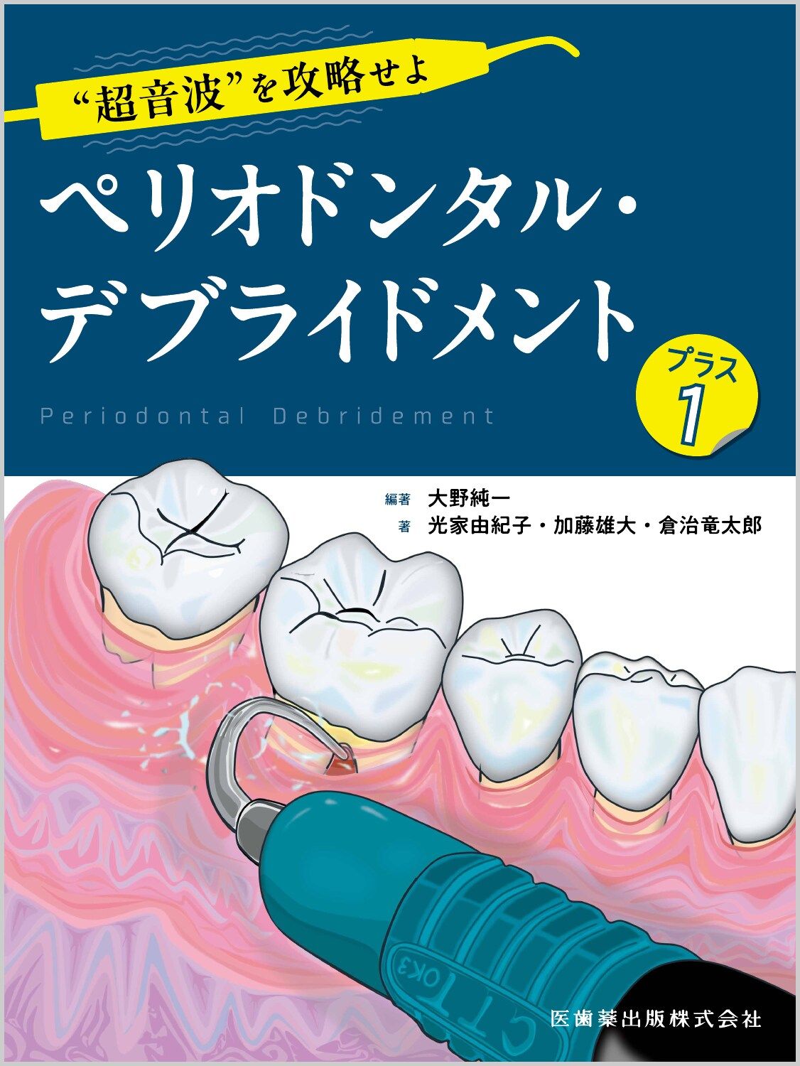 【裁断済】ペリオドンタル・デブライドメント 超音波”を攻略せよペリオドンタル・デブライドメント プラス1 大野純一