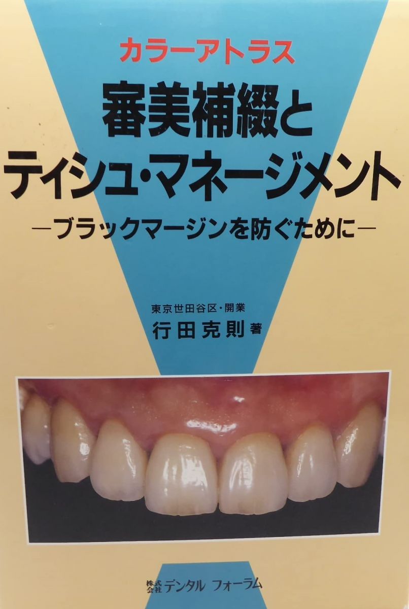 審美補綴とティシュ・マネージメント-ブラックマージンを防ぐために カラーアトラス 審美補綴とティシュ・マネージメント-ブラックマージンを防ぐために