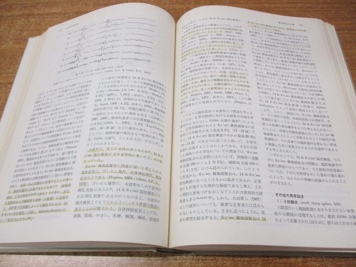 【美品】臨床脳波学　第6版　医学書院 臨床脳波学 第6版 | 大熊 輝雄 |本 | 通販 | Amazon