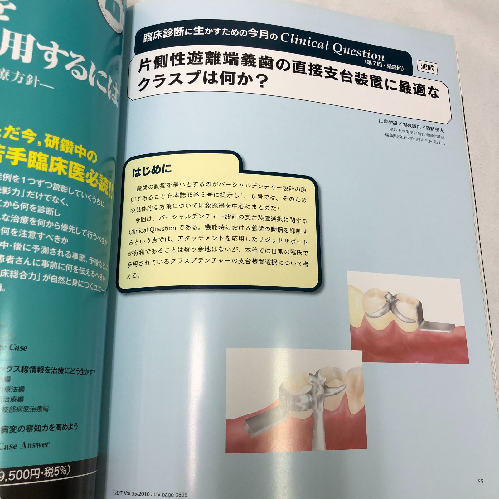 歯科専門書】歯科技工士・若き歯科医師のための補綴治療スキルアップ