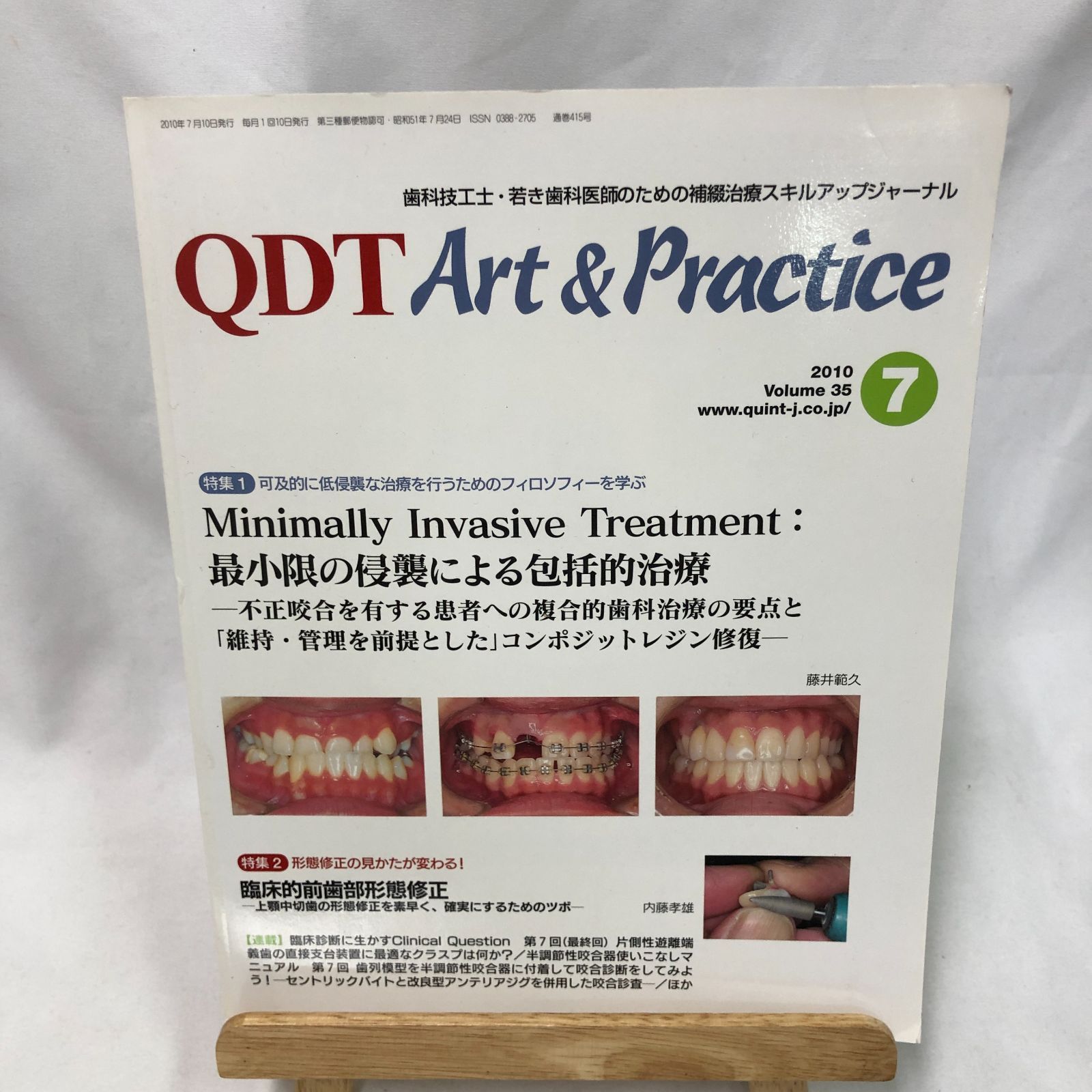 歯科専門書】歯科技工士・若き歯科医師のための補綴治療スキルアップ