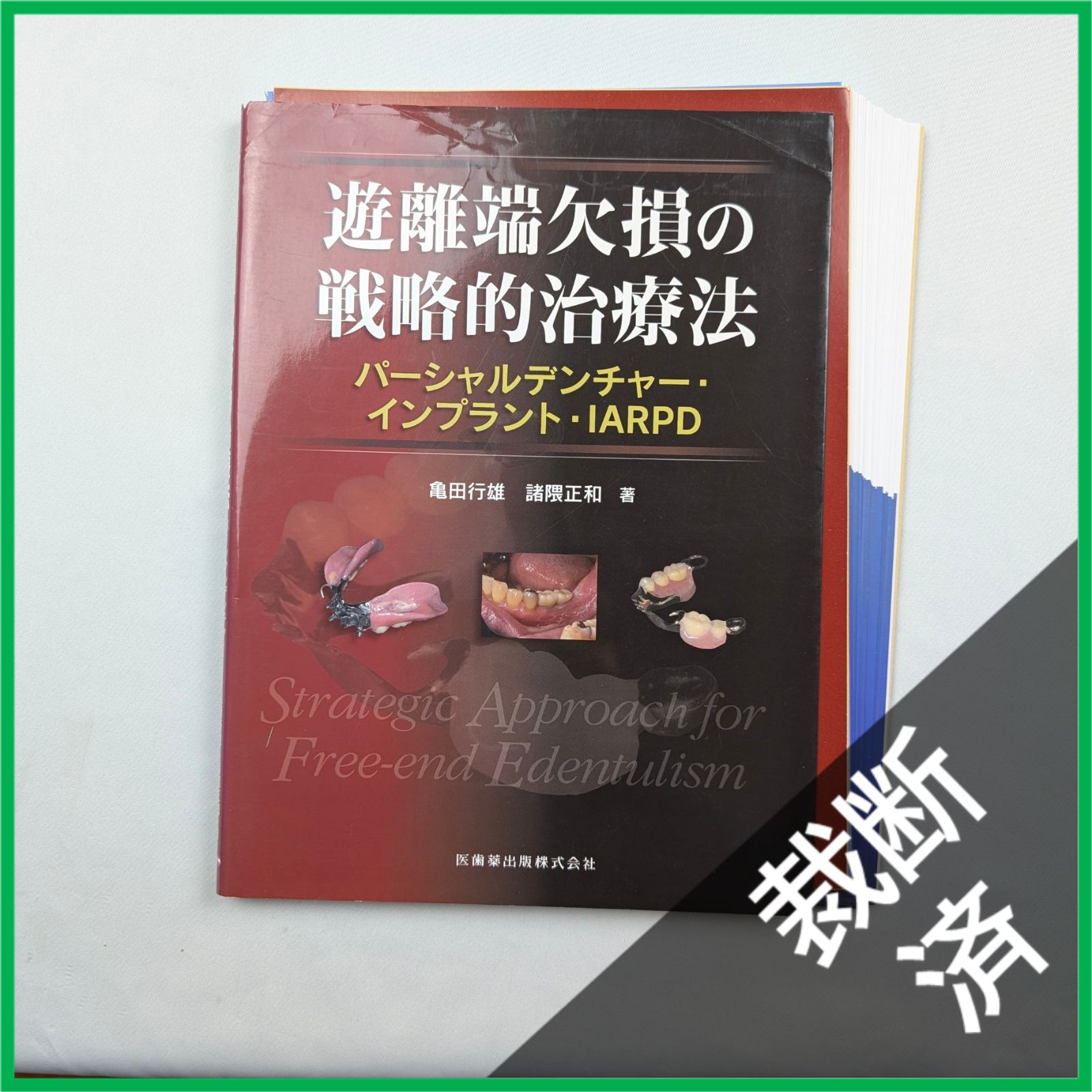 裁断済】遊離端欠損の戦略的治療法 パーシャルデンチャー