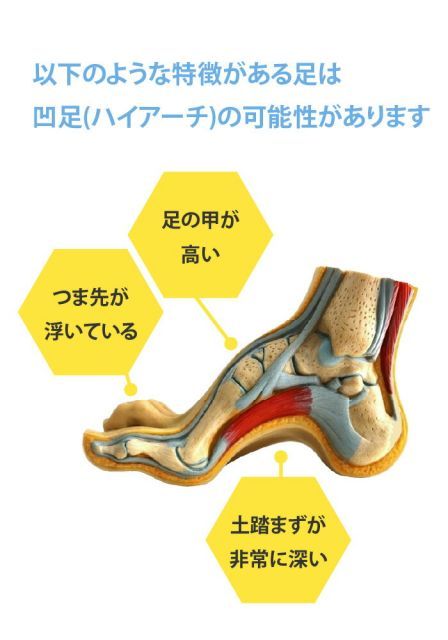 種類2：16cm 凹足 おうそく ハイアーチ インソール中敷き【リムジンインソール】韓国の中敷き専門店が開発した土踏まずサポートインソール 立ち仕事 歩くと痛い 炎症 症状 改善グッズ 矯正 対策 アーチサポーター 痛くない■insole-6-s