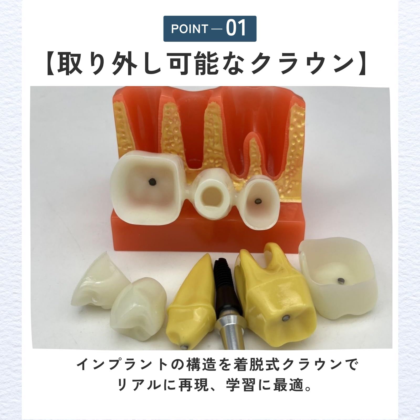 ideamall インプラント 模型 歯 講習 練習 モデル 教育 コンパクト