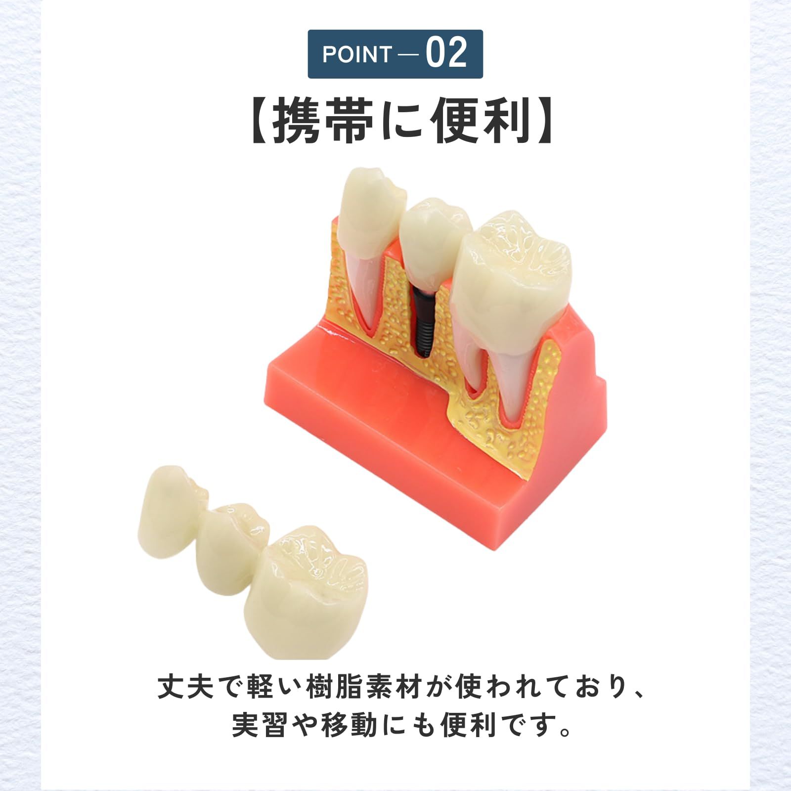 【最終出品8/9】インプラント模型 ideamall インプラント 模型 歯 講習 練習 モデル 教育 コンパクト