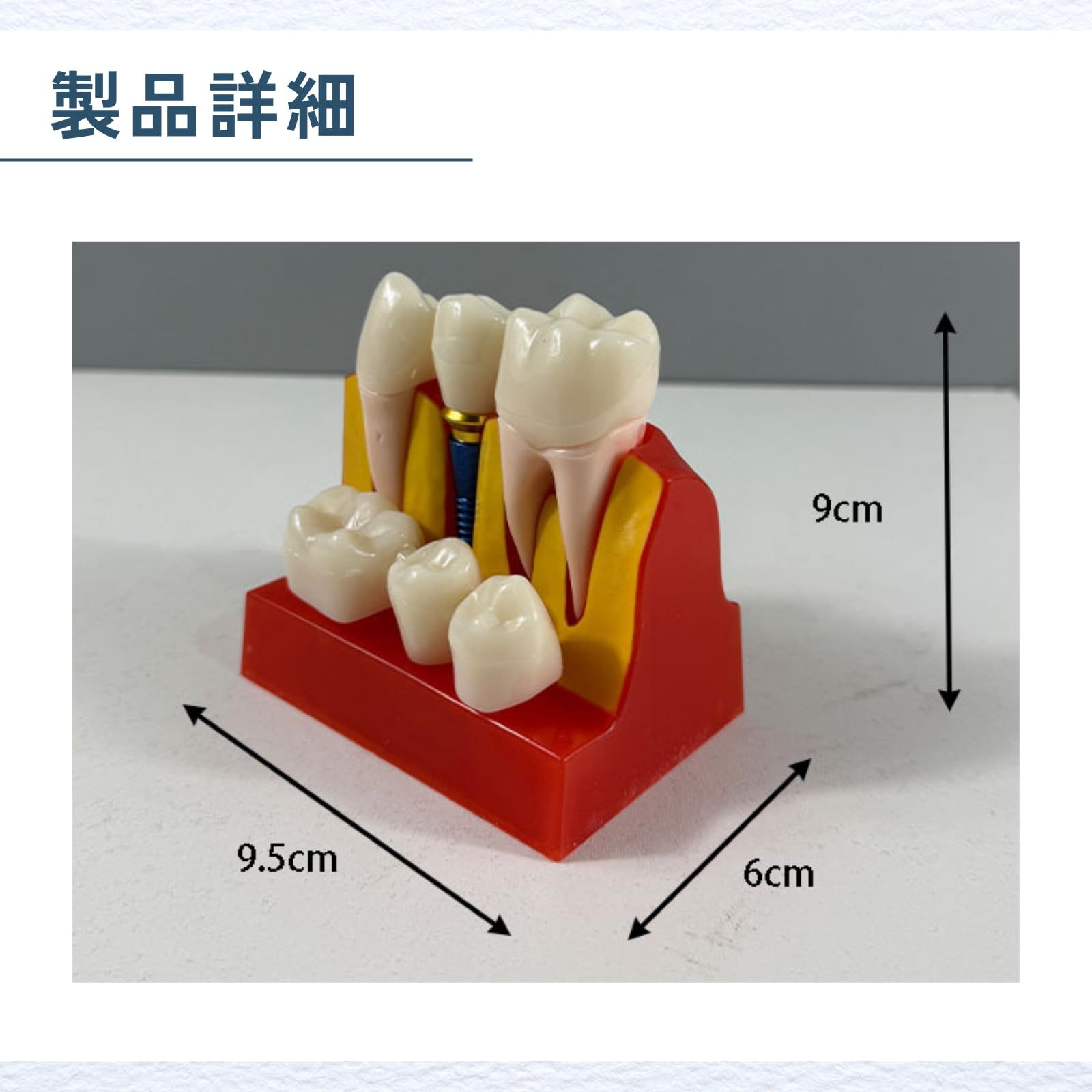 ideamall インプラント 模型 歯 講習 練習 モデル 教育 コンパクト