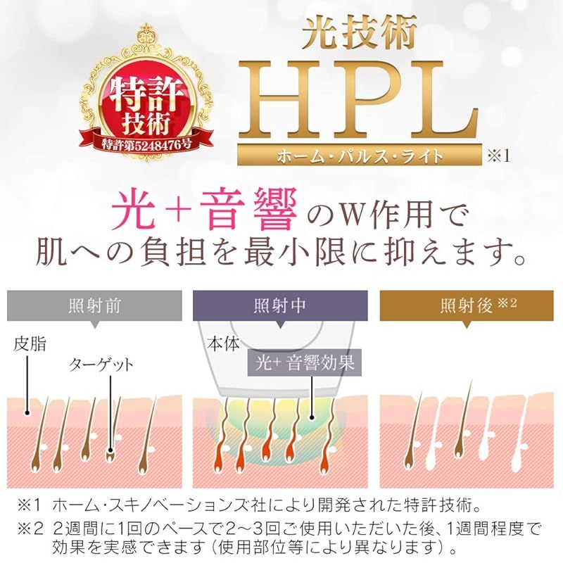 アイリスオーヤマ 光脱器 エピレタ 光美容器 15万発照射 全身 5段階調整 レディース メンズ 男女兼用 肌に優しい 全身ムダ毛処理 EP-0115-P 1