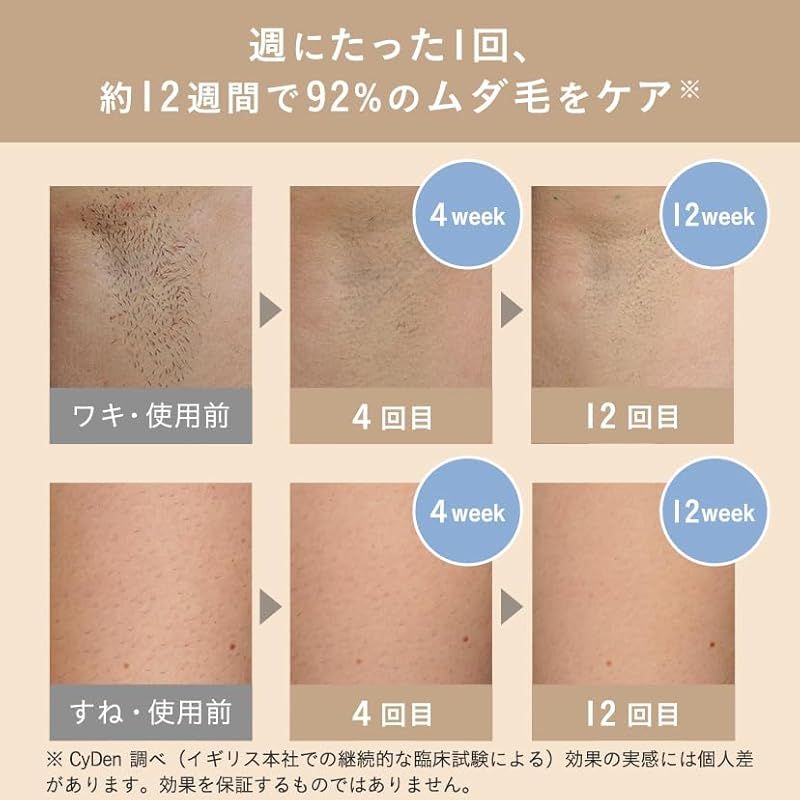 即納：スムーズスキン bare pop 脱毛器 収納ケース付きセット