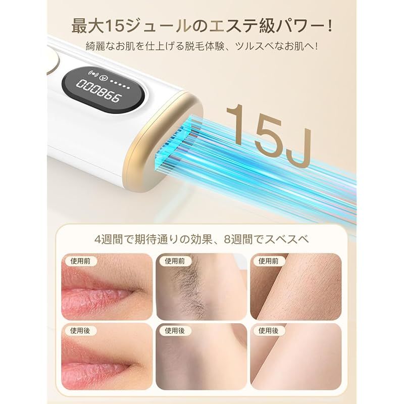 ケア頻度ご提案 5段階調節