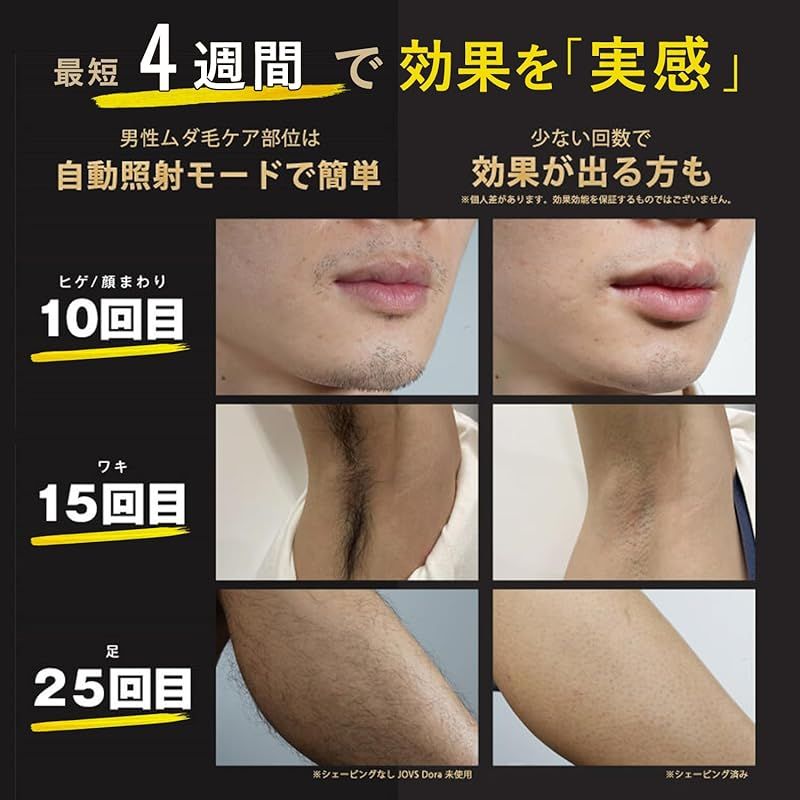 VIO対応 だつもうき