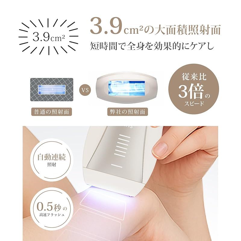 Yete（エイティー）脱毛器 IPL光脱毛器 サファイア冷却 SHR連続照射 Amazon | Yete（エイティー）脱毛器 IPL光脱毛器 サファイア冷却 SHR