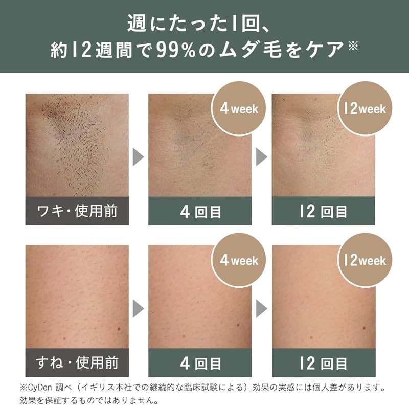 スムーズスキン pure adapt 収納ケース付きセット 脱毛器 レディース メンズ 家庭用脱毛器 光美容器 10段階調整 ムダ毛処理 ピンポイント照射 100万回照射 可動式ヘッド 連射 最速0 46秒の高速照射 冷却不要 IPL光 イギリス 英 0