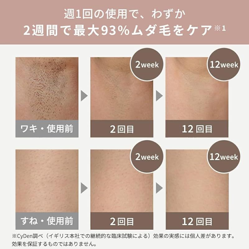 光美容器 パワー自動調整