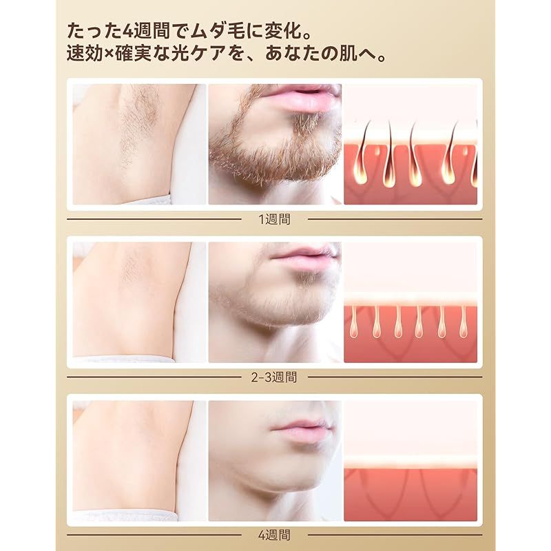 YUNDOO 脱毛器 VIO対応 新モデル 1台3役 HR SC RA サロン級冷感脱毛器 IPL光脱毛器 メンズ レディース 脱毛モ一ド スキンケア 美肌モード 双重冷却アイス技術 無痛脱毛 9段階調節 19 8 J高出力 9 1