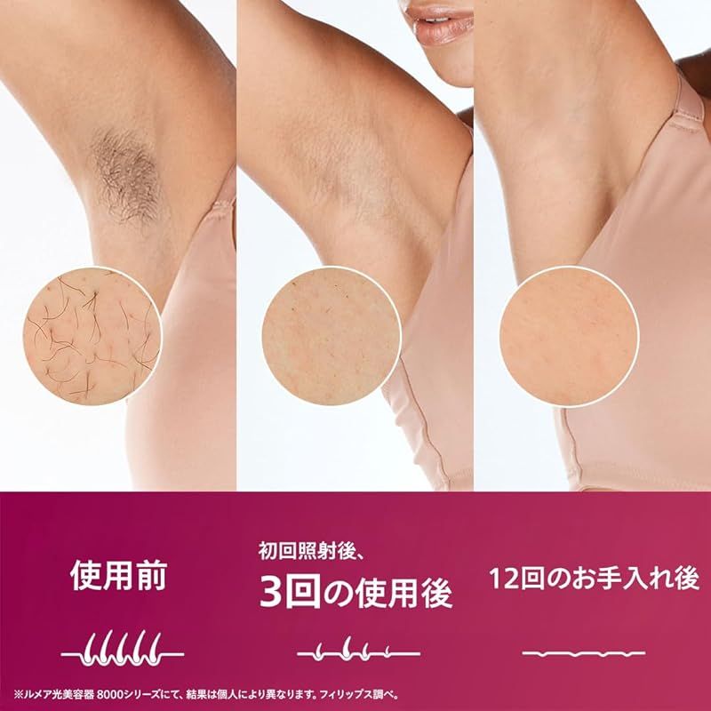 フィリップス 光美容器 ルメア 8000 男女兼用 初回照射後3回で実感 VIライン 顔 全身アタッチメント付 BRI 949 70 パールピンク co jp 1