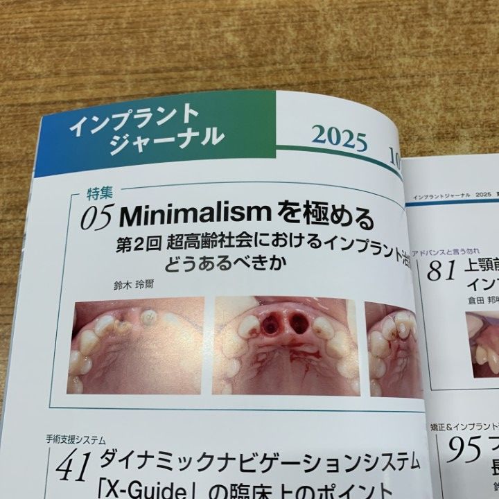 ゆき　インプラントジャーナル ○01)【1点限り!】IMPLANT JOURNAL/インプラントジャーナル 102号