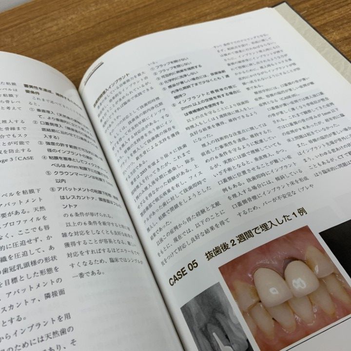 △01)【1点限り!】イミディエートインプラントロジー/林揚春/武田孝之