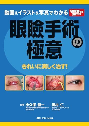 動画＆イラスト＆写真でわかる眼瞼手術の 意 きれいに美しく治す