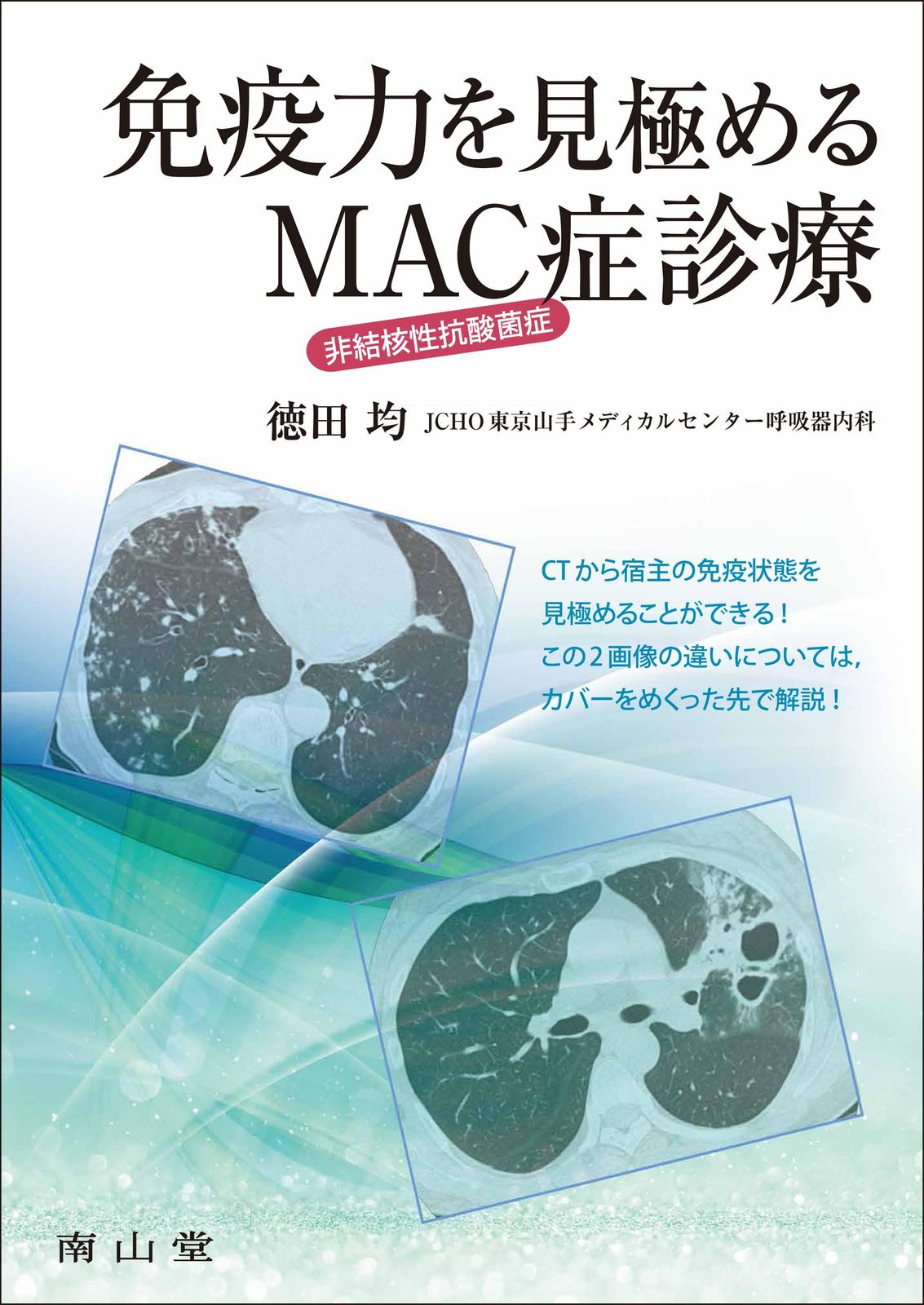 免疫力を見 める 非結核性抗酸菌症 MAC症 診療