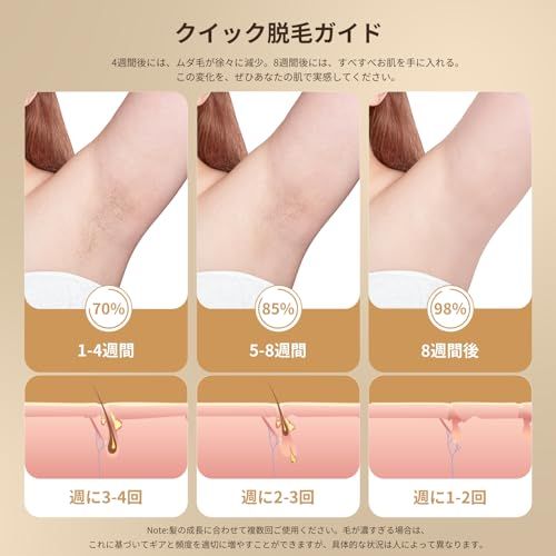 全身脱毛 レーザー