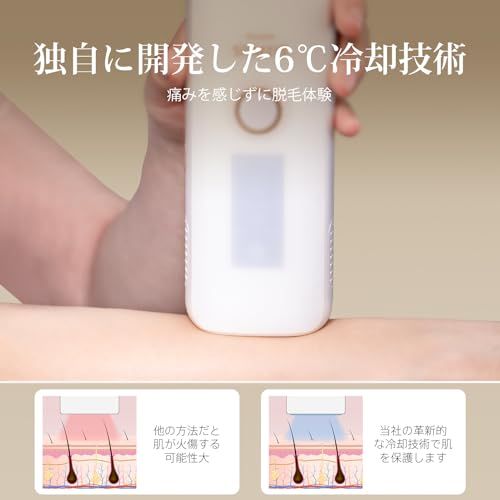 送料無料】SIXPLUS Technology 脱毛器 光美容器 冷感IPL脱毛器 男女