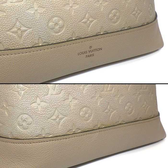 44885 トゥルトレール