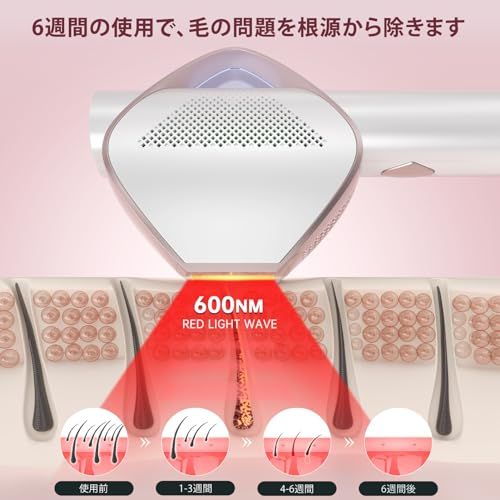 OPTテクノロジー＆サロン級IPL光脱毛器 VIO対応