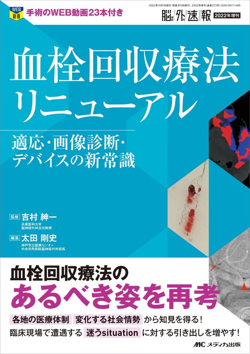 血栓回収療法リニューアル: 適応・画像診断・デバイスの新常識 (脳神経