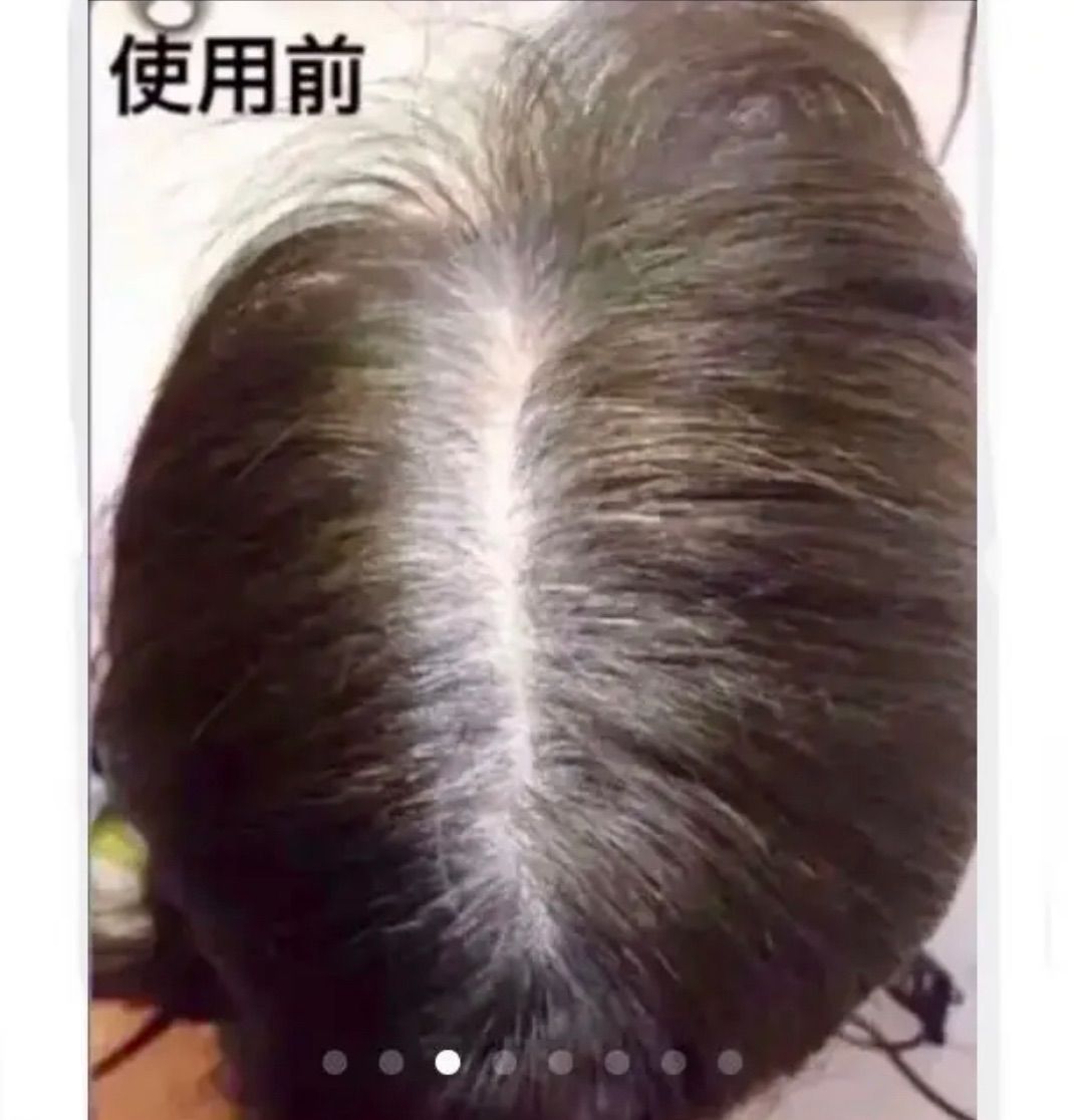 薄毛増毛ふりかけパウダー詰め替え用お得4個セット脱毛症分け目白髪かくしハゲ隠し 薄毛増毛ふりかけパウダー詰め替え用お得4個セット脱毛症分け目白髪かくし