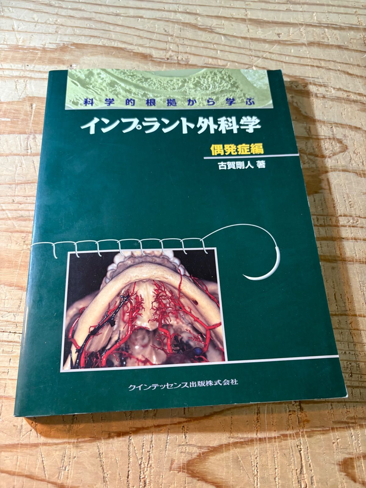 科学的根拠から学ぶインプラント - メルカリ