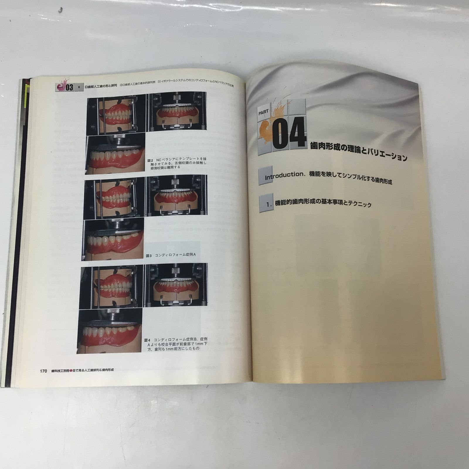 1258 月刊歯科技工 別冊 目で見る人工歯排列＆歯肉形成 医歯薬出版