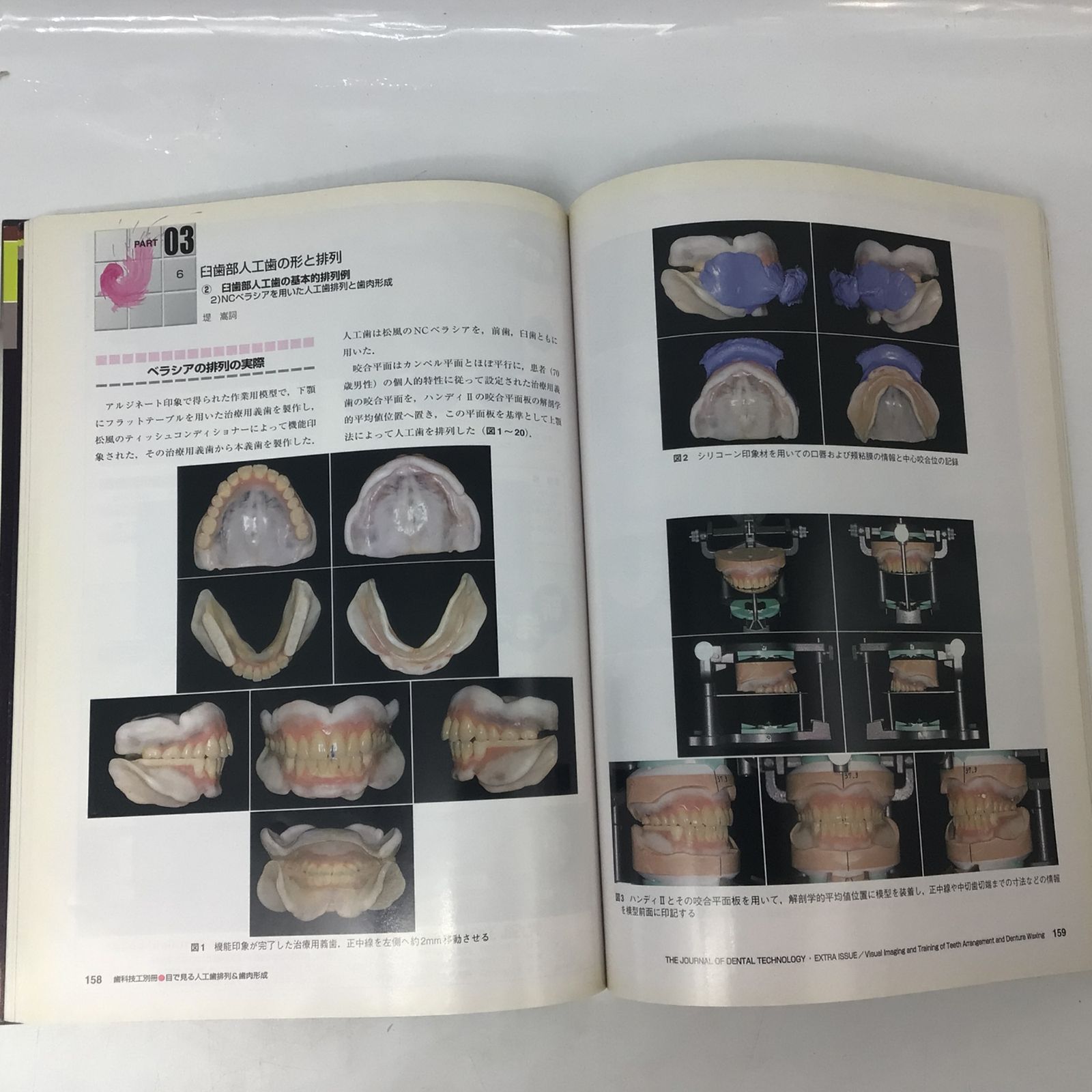 1258 月刊歯科技工 別冊 目で見る人工歯排列＆歯肉形成 医歯薬出版