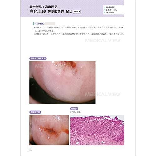 コルポ診の臨床ABC?第3版 - メルカリ