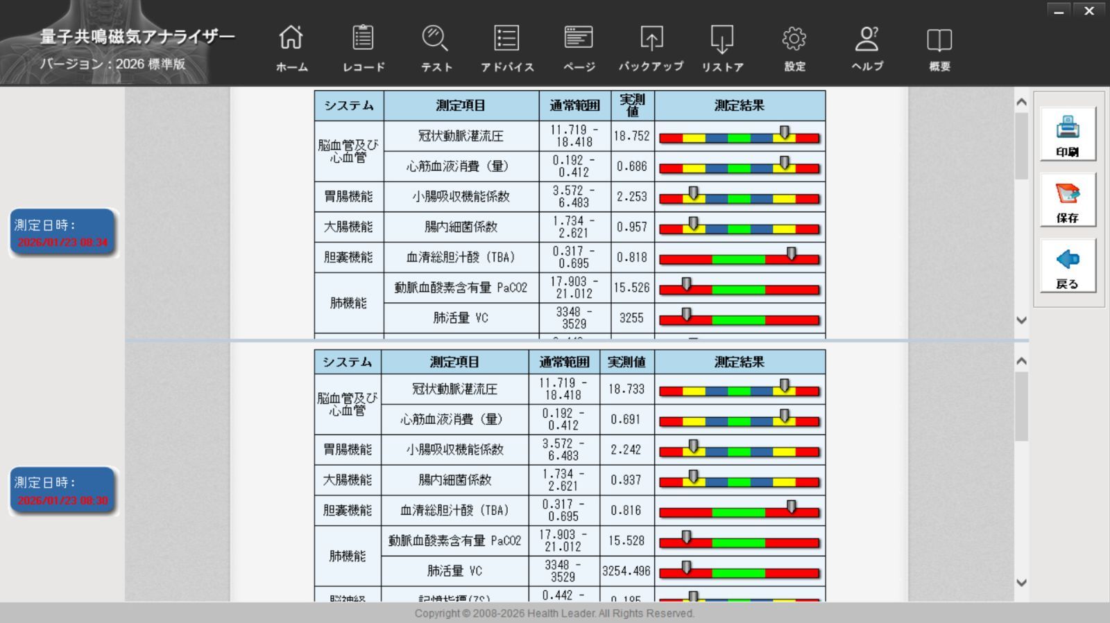 2026年最新 中古PC付 量子アナライザー 波動測定器 健康管理 ヘルス