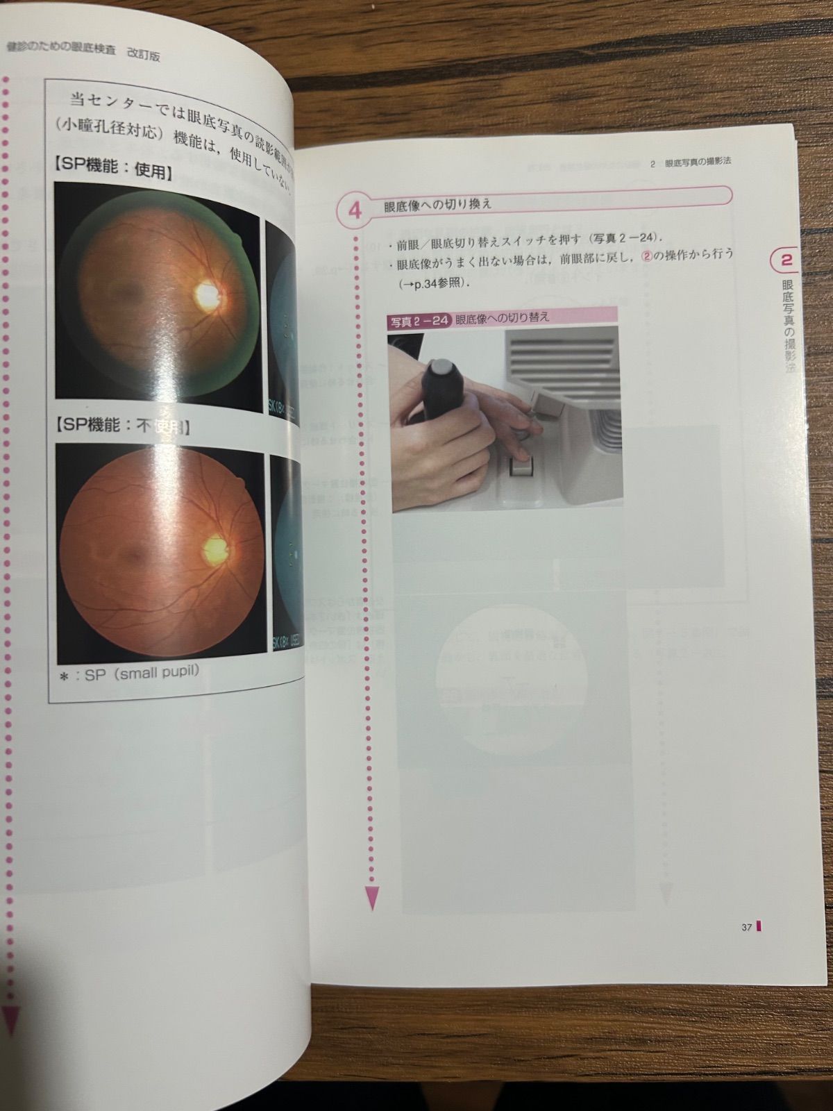 にとるようにわかる健診のための眼底検査 : 無散瞳カメラによる撮影と