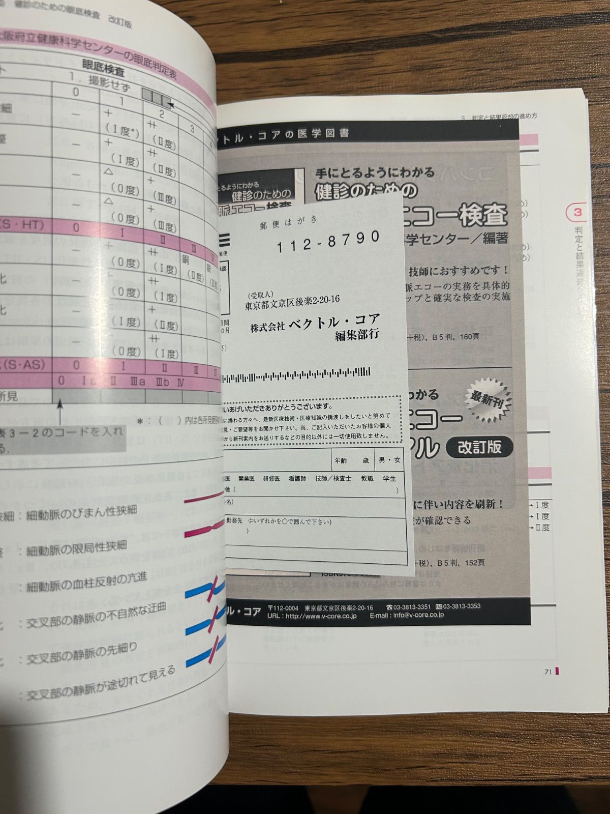 健診のための眼底検査 改訂版〜無散瞳カメラによる撮影
