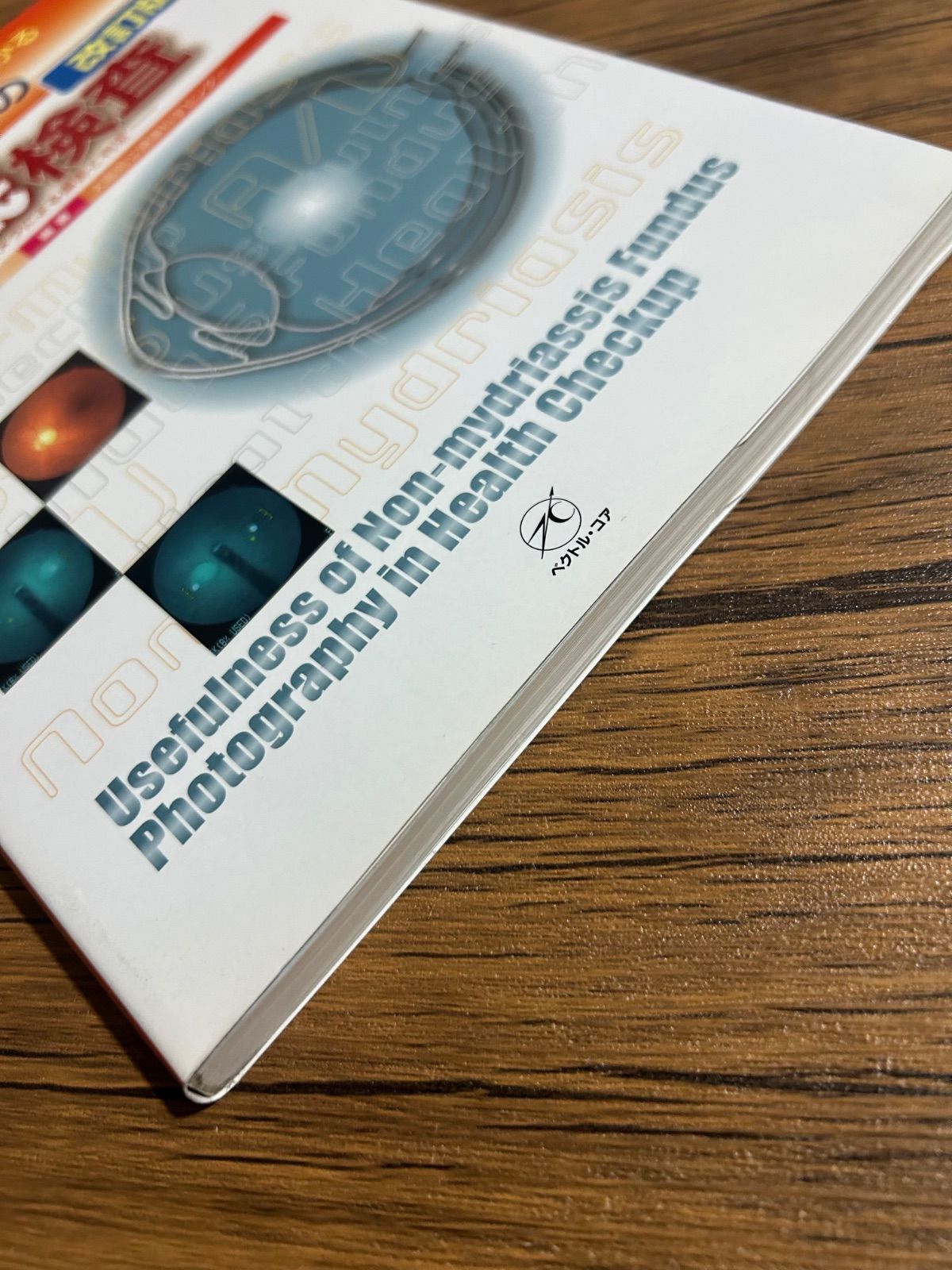 手にとるようにわかる健診のための眼底検査 : 無散瞳カメラによる撮影と判定 手にとるようにわかる健診のための眼底検査 無散瞳カメラによる撮影と